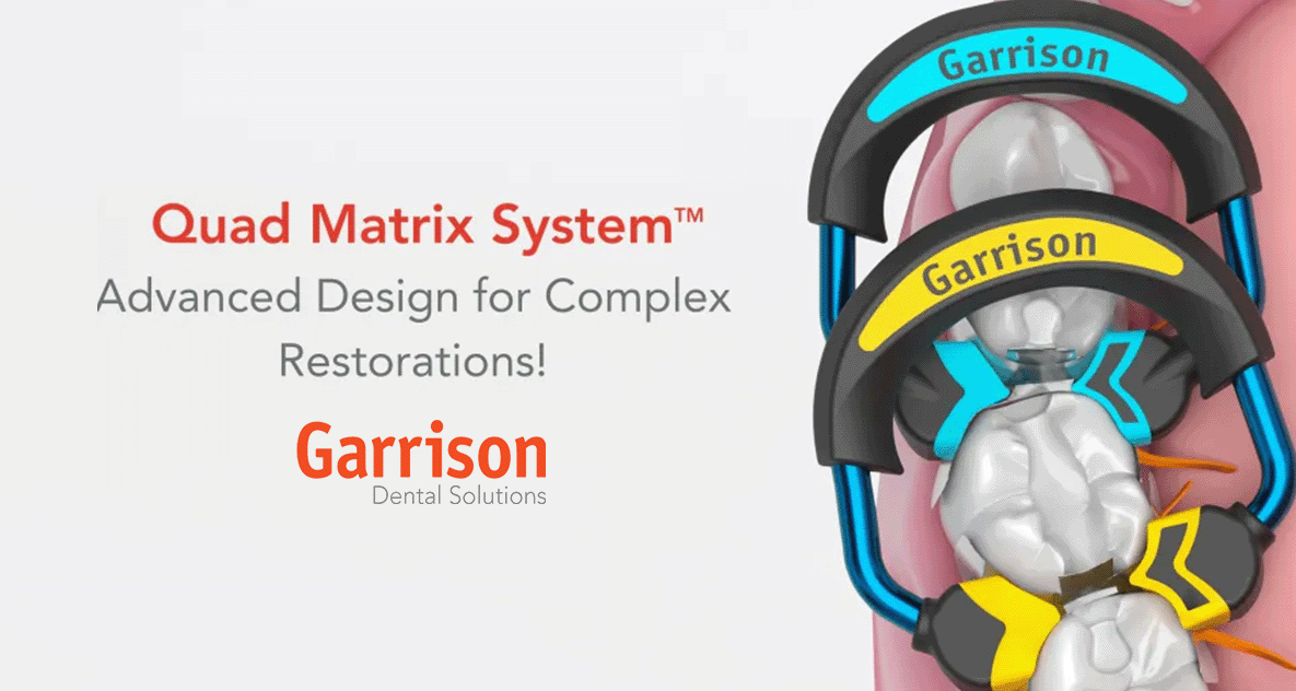Class II Restorations with the Garrison Quad Matrix System